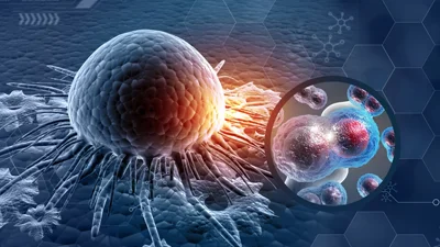 Uro-Oncology